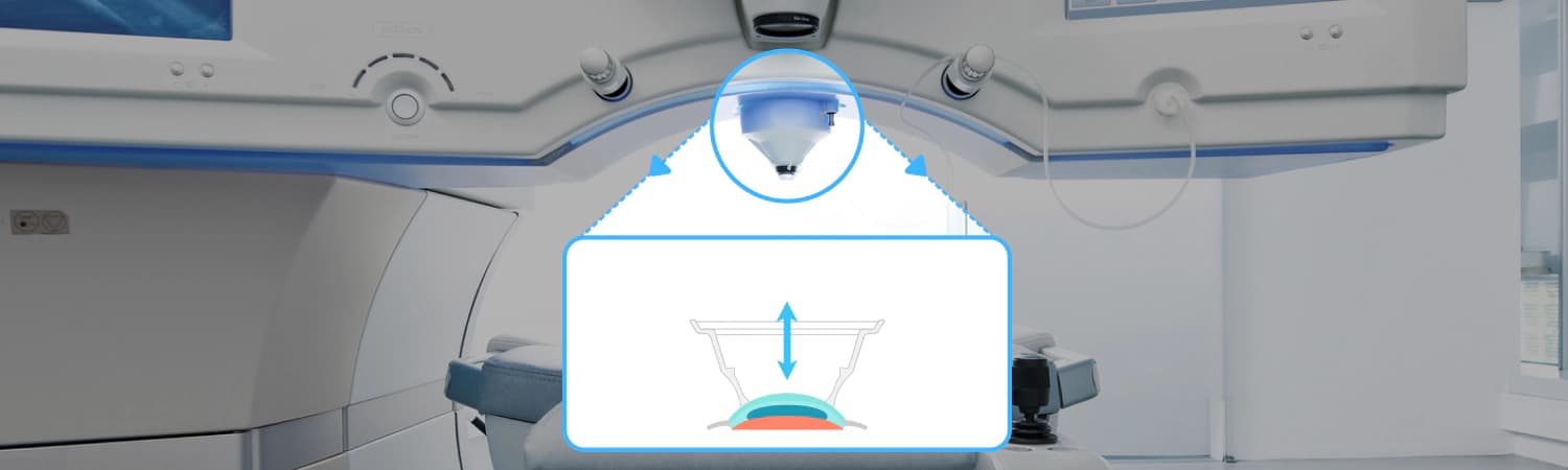 음압 안구 고정 시스템