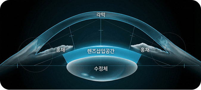 초정밀 안구 분석으로 개인별 변수까지 정확하게 파악