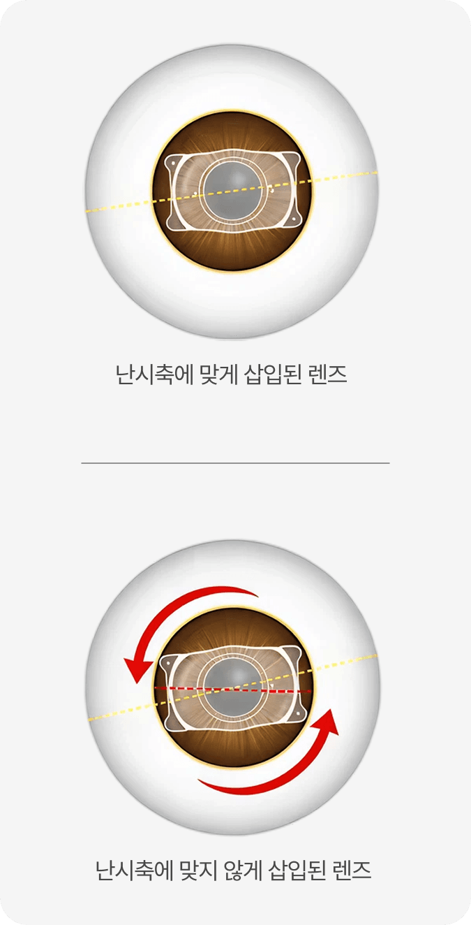 초정밀 안구 분석으로 개인별 변수까지 정확하게 파악