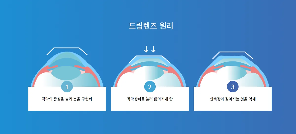 드림렌즈 원리 드림렌즈 원리